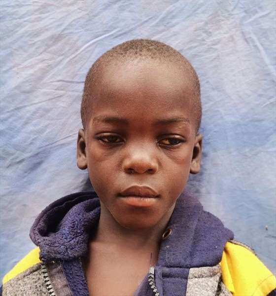 برينس فريد سكوناشي سكوناشي